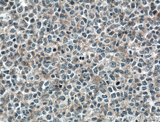 MYO9B Antibody in Immunohistochemistry (Paraffin) (IHC (P))