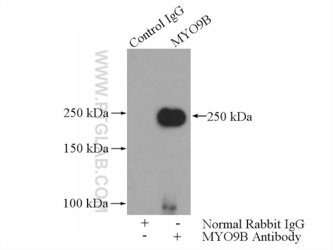 MYO9B Antibody in Immunoprecipitation (IP)