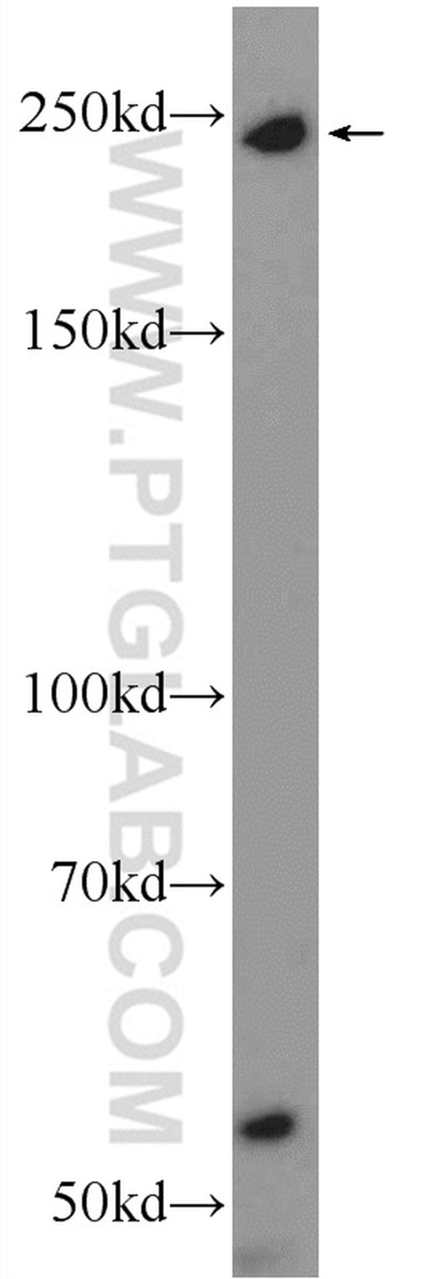 MYO9B Antibody in Western Blot (WB)