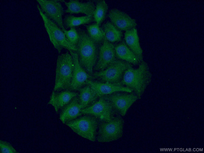 HOMER1 Antibody in Immunocytochemistry (ICC/IF)