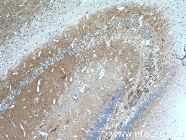 HOMER1 Antibody in Immunohistochemistry (Paraffin) (IHC (P))