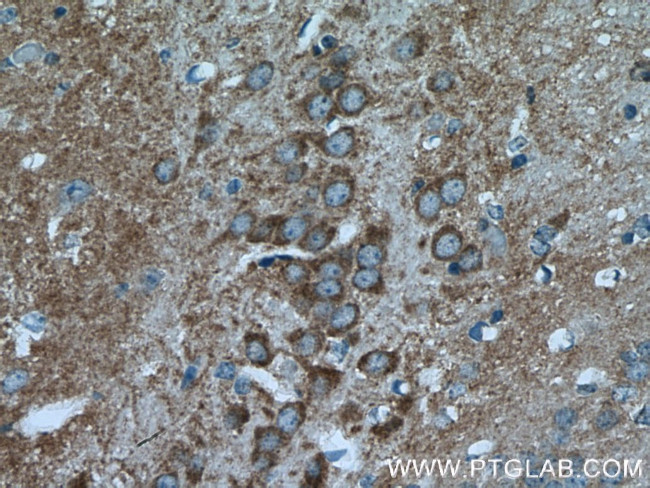 HOMER1 Antibody in Immunohistochemistry (Paraffin) (IHC (P))