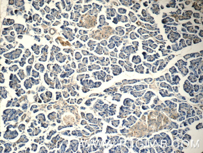 HOMER1 Antibody in Immunohistochemistry (Paraffin) (IHC (P))