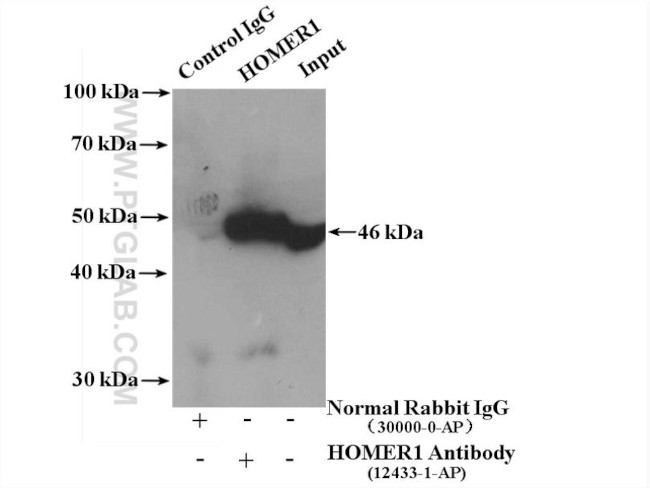 HOMER1 Antibody in Immunoprecipitation (IP)