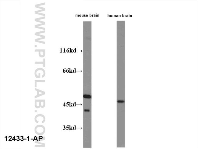 HOMER1 Antibody in Western Blot (WB)