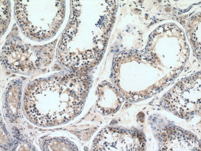 STAM Antibody in Immunohistochemistry (Paraffin) (IHC (P))