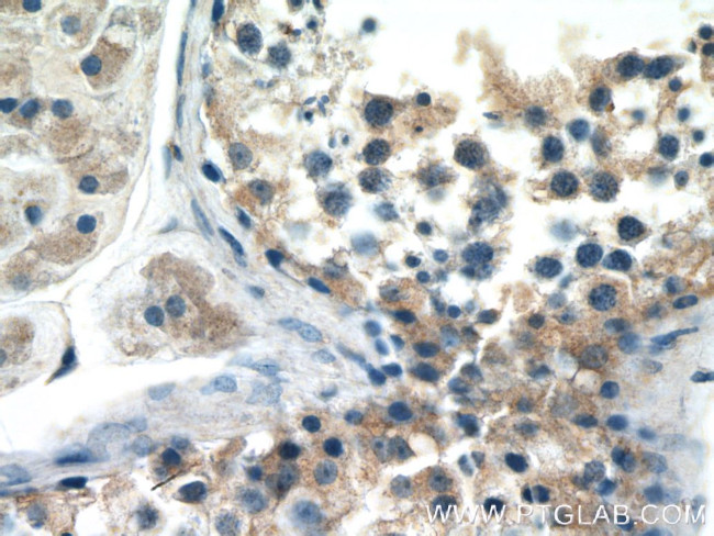 STAM Antibody in Immunohistochemistry (Paraffin) (IHC (P))