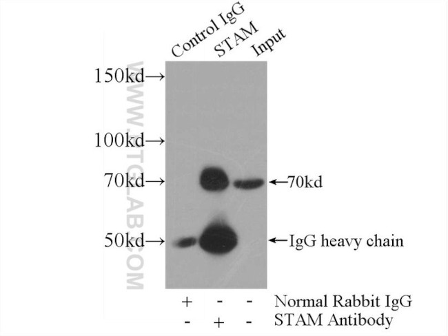 STAM Antibody in Immunoprecipitation (IP)