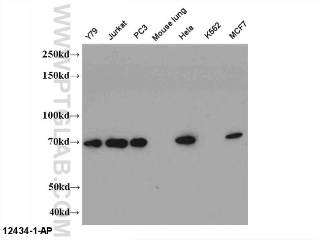 STAM Antibody in Western Blot (WB)