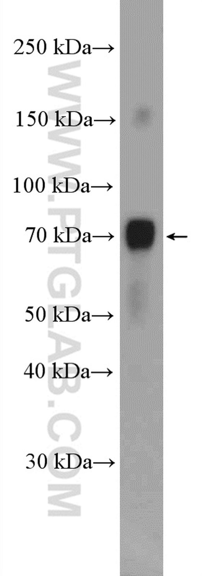 STAM Antibody in Western Blot (WB)