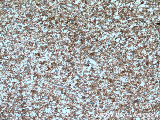 SH3GL2 Antibody in Immunohistochemistry (Paraffin) (IHC (P))