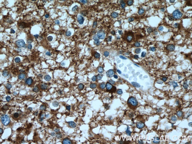 SH3GL2 Antibody in Immunohistochemistry (Paraffin) (IHC (P))