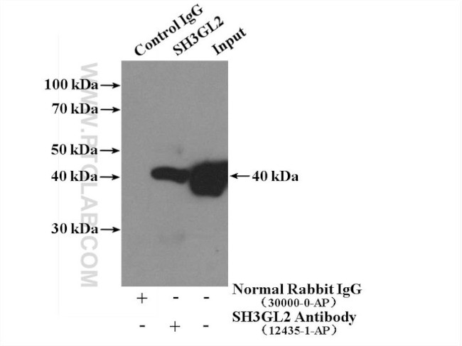 SH3GL2 Antibody in Immunoprecipitation (IP)