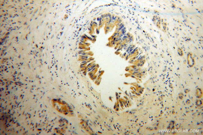 SHC3 Antibody in Immunohistochemistry (Paraffin) (IHC (P))