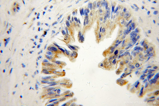 SHC3 Antibody in Immunohistochemistry (Paraffin) (IHC (P))