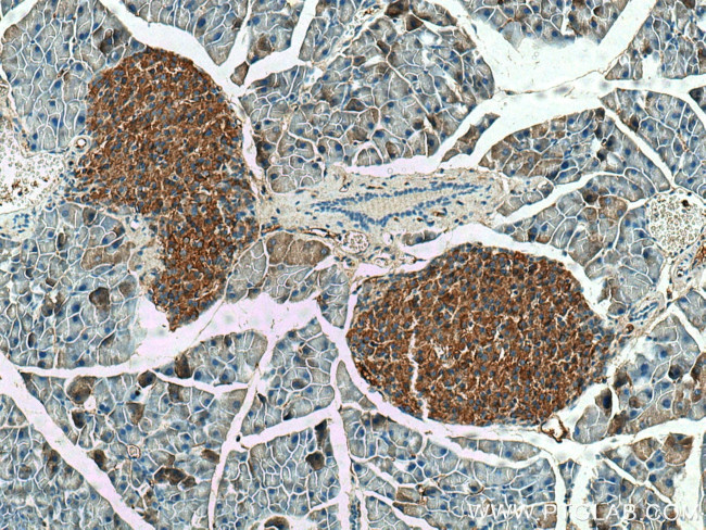 SHC3 Antibody in Immunohistochemistry (Paraffin) (IHC (P))