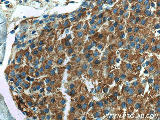 SHC3 Antibody in Immunohistochemistry (Paraffin) (IHC (P))