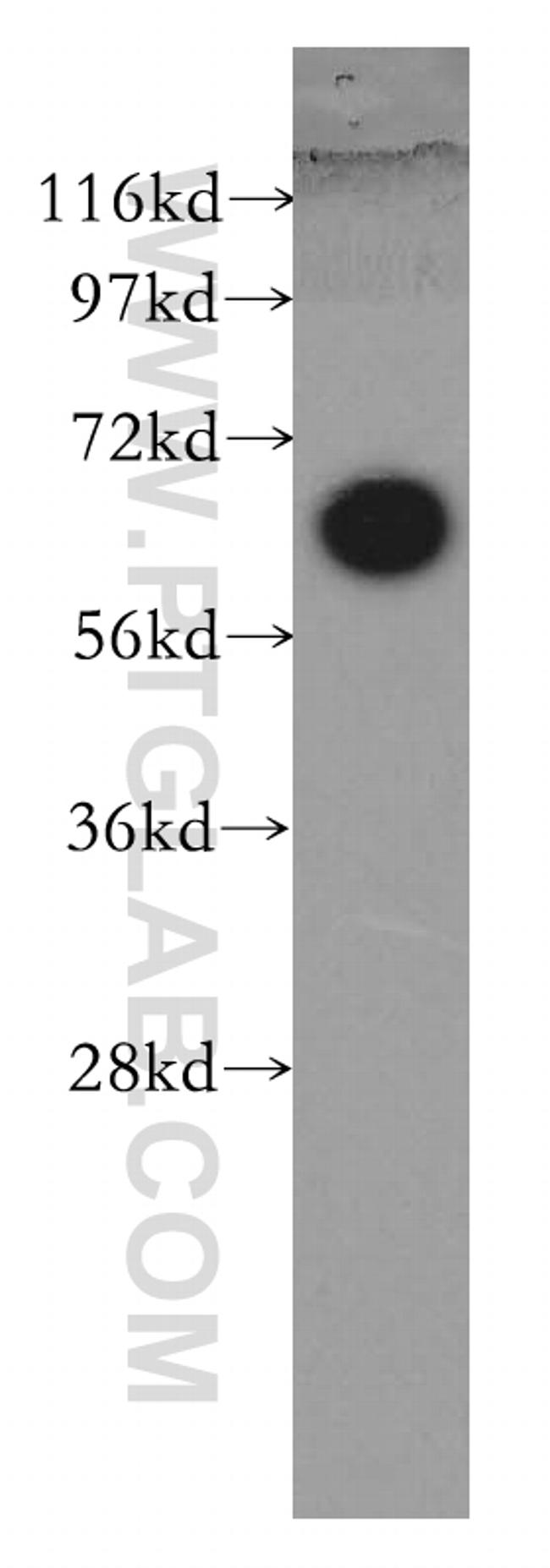 SHC3 Antibody in Western Blot (WB)