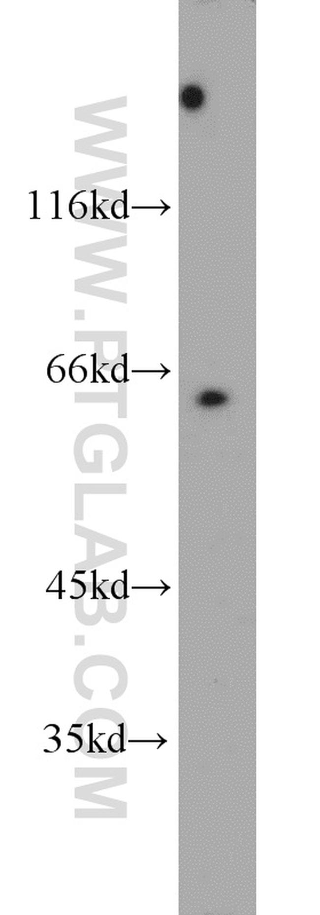 SHC3 Antibody in Western Blot (WB)