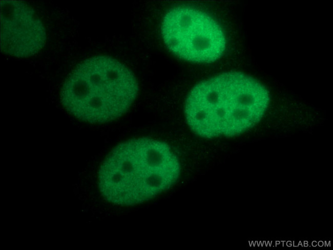 CREST Antibody in Immunocytochemistry (ICC/IF)