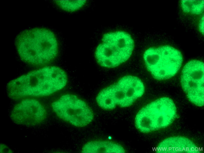 CREST Antibody in Immunocytochemistry (ICC/IF)