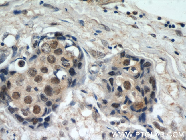 CREST Antibody in Immunohistochemistry (Paraffin) (IHC (P))