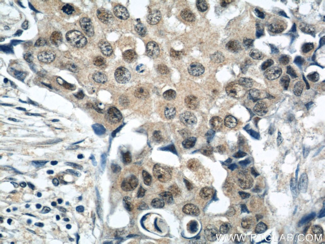 CREST Antibody in Immunohistochemistry (Paraffin) (IHC (P))