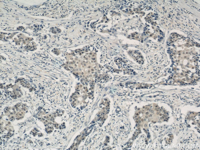 CREST Antibody in Immunohistochemistry (Paraffin) (IHC (P))