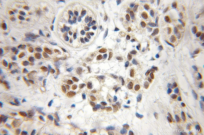 CREST Antibody in Immunohistochemistry (Paraffin) (IHC (P))