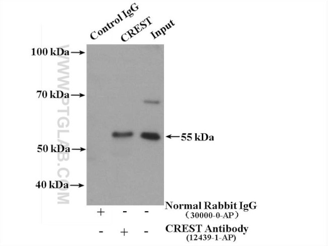 CREST Antibody in Immunoprecipitation (IP)