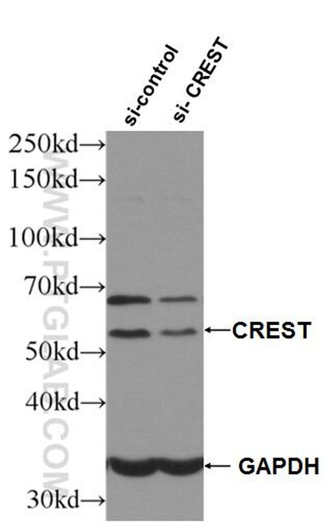 CREST Antibody in Western Blot (WB)