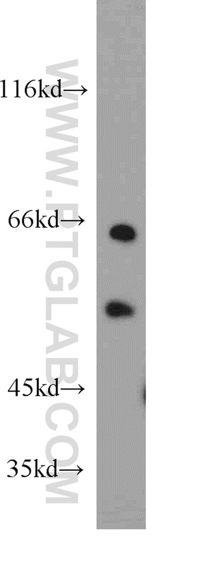 CREST Antibody in Western Blot (WB)