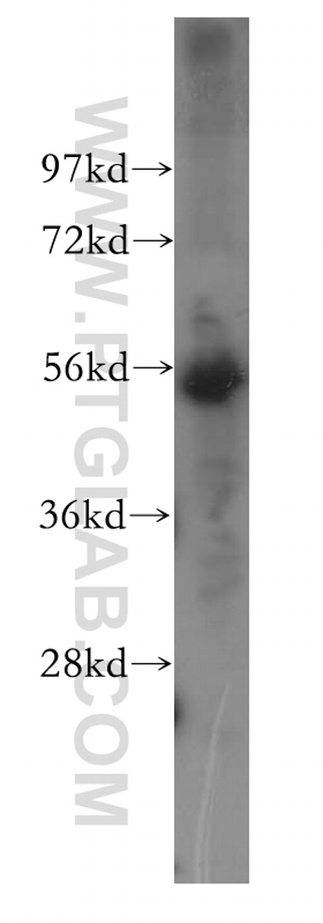 CREST Antibody in Western Blot (WB)