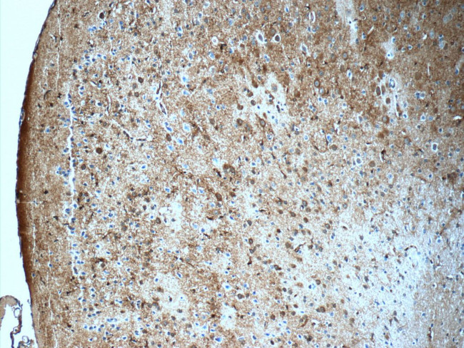 PDE1A Antibody in Immunohistochemistry (Paraffin) (IHC (P))