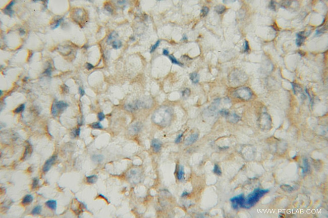 PDE1A Antibody in Immunohistochemistry (Paraffin) (IHC (P))