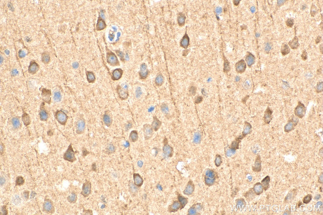 PDE1A Antibody in Immunohistochemistry (Paraffin) (IHC (P))