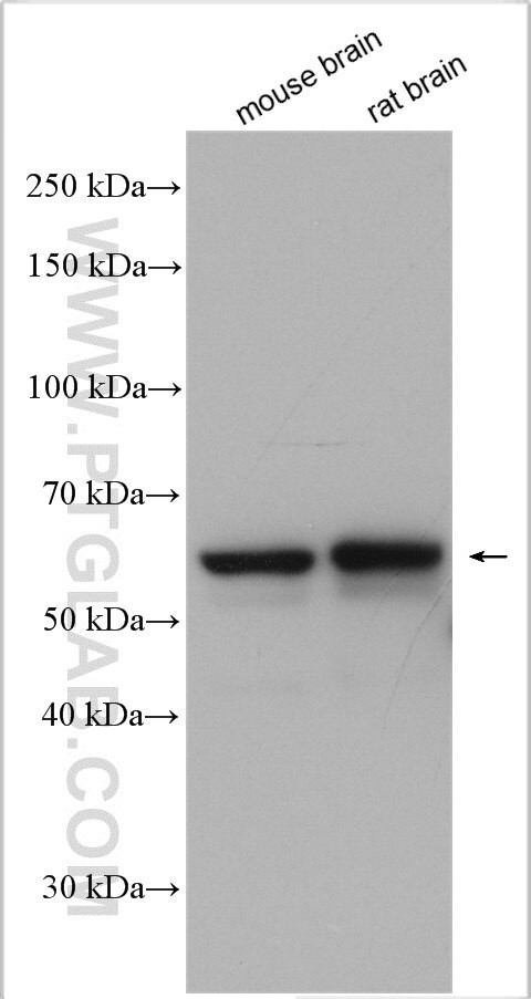 PDE1A Antibody in Western Blot (WB)