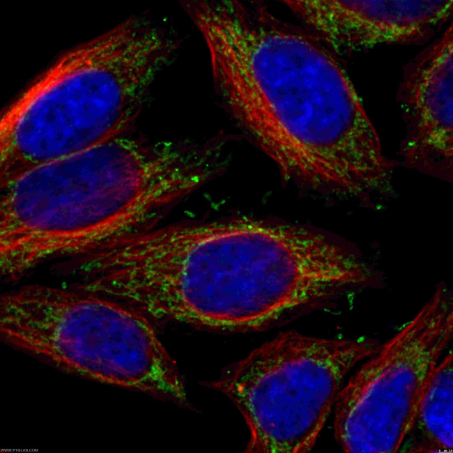 NDUFS1 Antibody in Immunocytochemistry (ICC/IF)