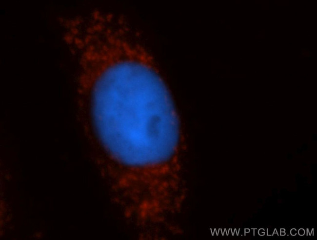 NDUFS1 Antibody in Immunocytochemistry (ICC/IF)