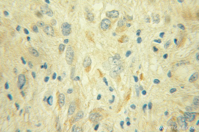 NDUFS1 Antibody in Immunohistochemistry (Paraffin) (IHC (P))