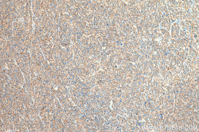 NDUFS1 Antibody in Immunohistochemistry (Paraffin) (IHC (P))