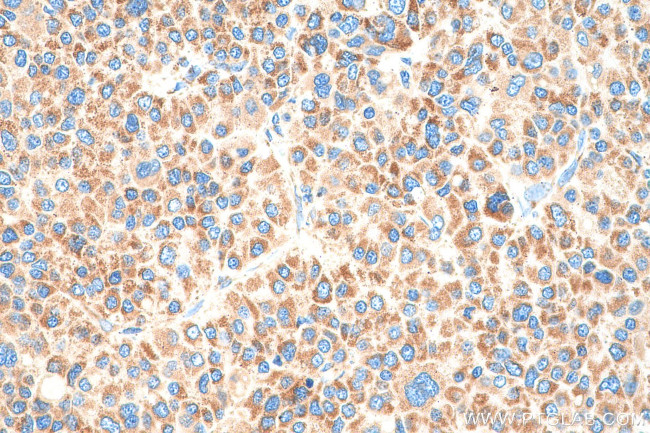 NDUFS1 Antibody in Immunohistochemistry (Paraffin) (IHC (P))