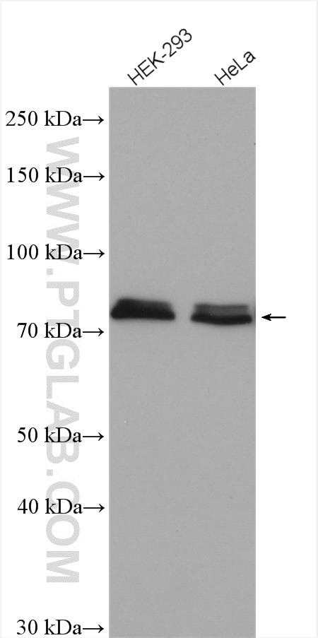 NDUFS1 Antibody in Western Blot (WB)