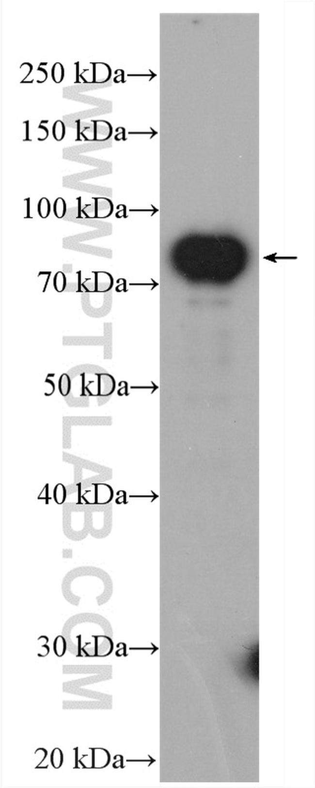 NDUFS1 Antibody in Western Blot (WB)