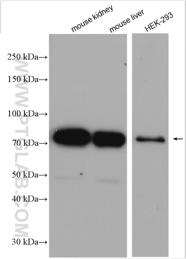 NDUFS1 Antibody in Western Blot (WB)