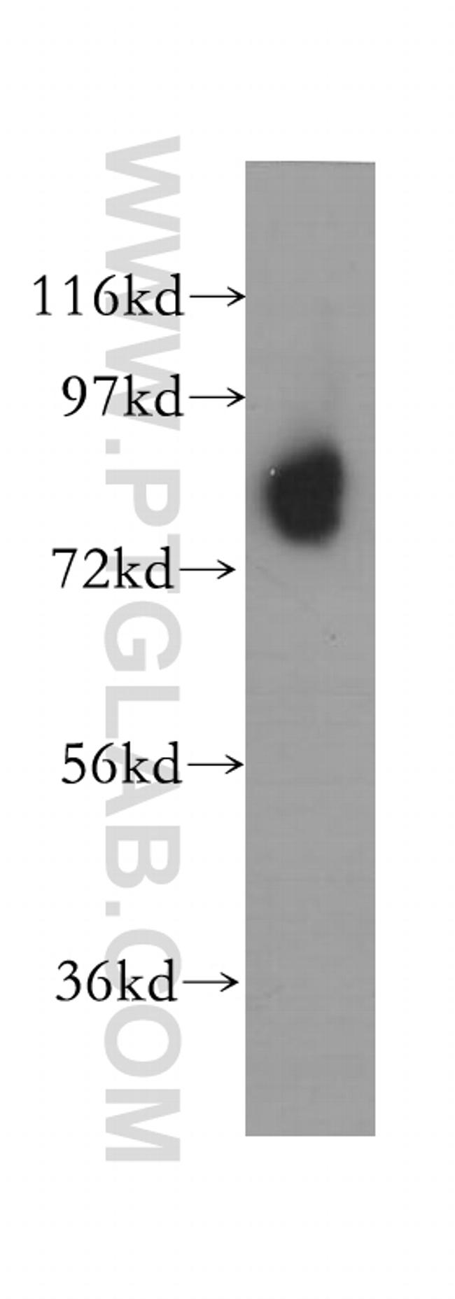 NDUFS1 Antibody in Western Blot (WB)