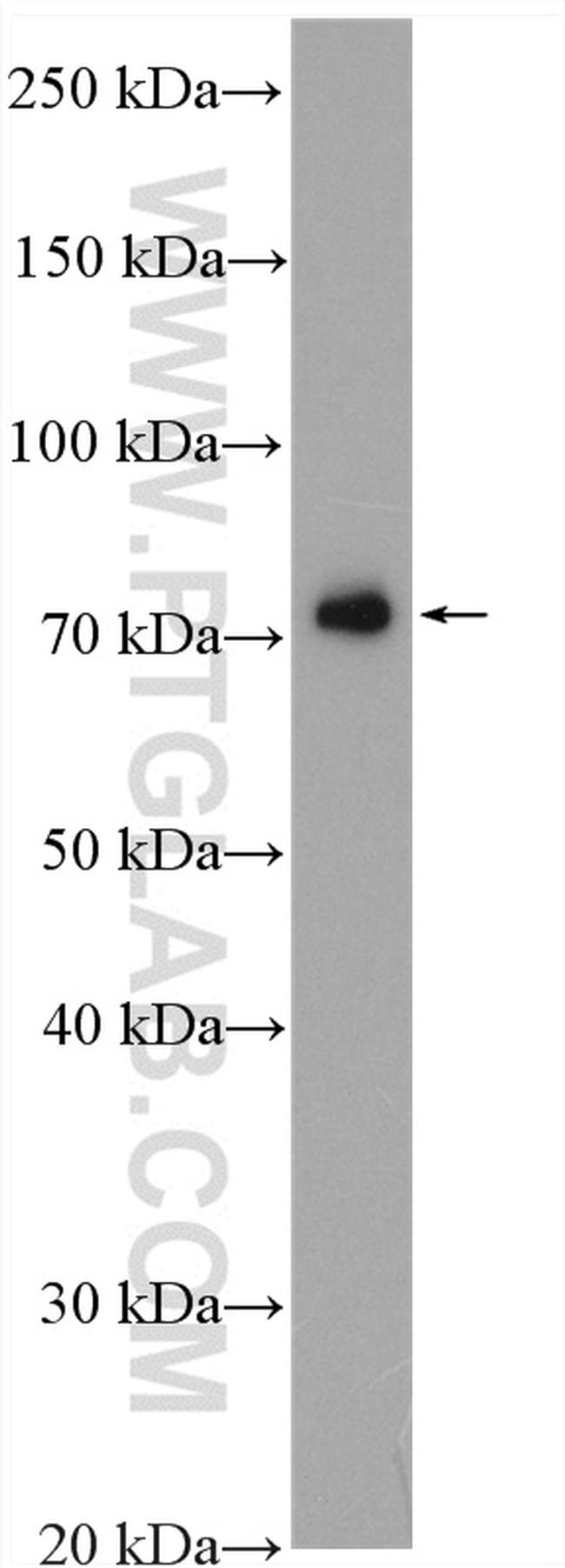 NDUFS1 Antibody in Western Blot (WB)