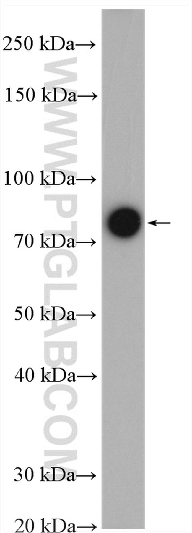 NDUFS1 Antibody in Western Blot (WB)