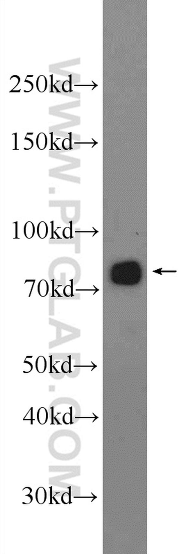 NDUFS1 Antibody in Western Blot (WB)