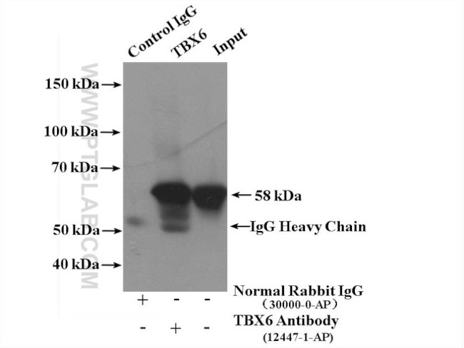 TBX6 Antibody in Immunoprecipitation (IP)